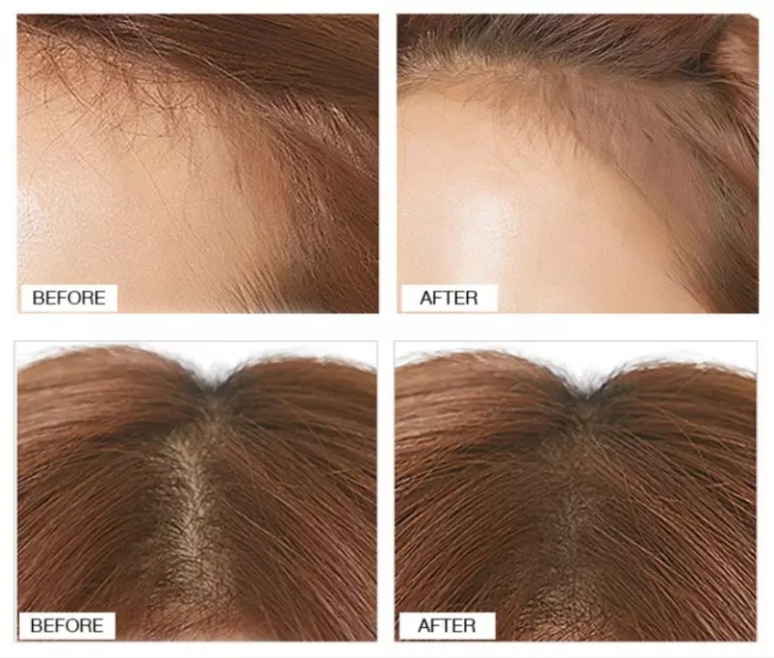 Hairline-Filling-Root-Cover-Up-Powder1 (1)